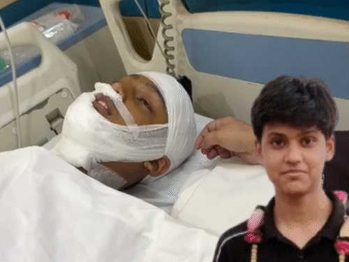 बरेली: चाइनीज मांझे से राज्यमंत्री के भतीजे की गर्दन कटी, बैन के बावजूद बिक्री पर भड़के मंत्री